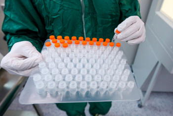 Фотография к новости: 68 новых ковид-больных выявили за сутки в Казахстане