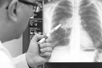 Фотография к новости: Три человека скончались от коронавирусной пневмонии за сутки в РК