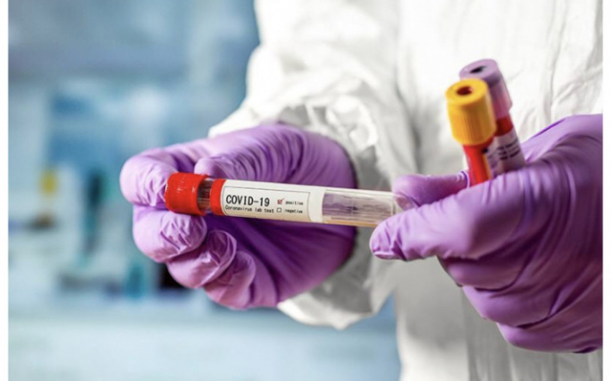 78 человек заболели COVID-19 за сутки в Казахстане