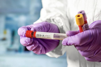 Фотография к новости: 78 человек заболели COVID-19 за сутки в Казахстане