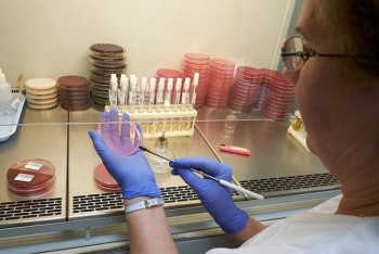 Фотография к новости: 65 новых случаев коронавируса выявили за сутки в Казахстане