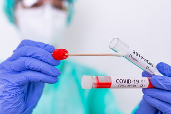 Фотография к новости: 64 новых случая COVID-19 зарегистрировали за сутки в Казахстане