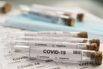 Фотография к новости: Новый скандал в "СК-Фармация": дистрибьютор отказался от покупки ПЦР-тестов из-за ненадобности