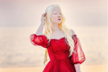 Фотография к новости: Девочка-альбинос из Казахстана снялась в рекламе американской продукции