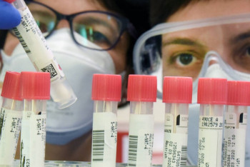 Фотография к новости: На 102 человека пополнилась за сутки казахстанская статистика по COVID-19