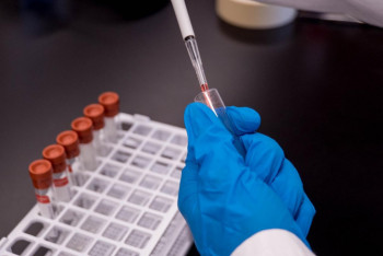 Фотография к новости: 104 новых случая COVID-19 зарегистрировали за сутки в Казахстане