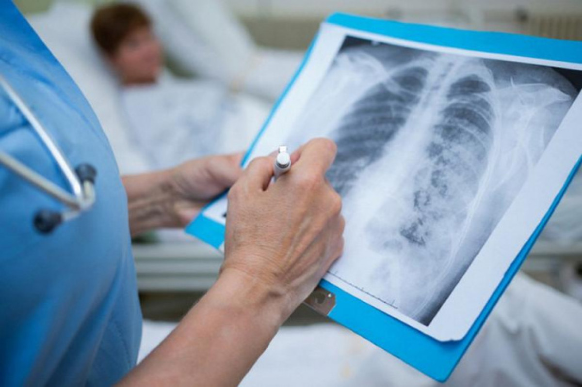 220 человек заболели коронавирусной пневмонией за сутки в РК