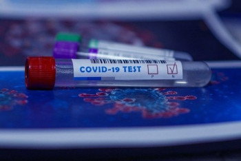 Фотография к новости: Мошенники стали продавать отрицательные тесты на коронавирус