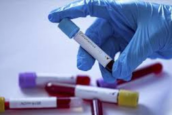 Фотография к новости: Еще 117 человек выздоровели от COVID-19 в Казахстане