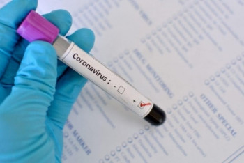 Фотография к новости: 449 человек заболели коронавирусом за сутки в Казахстане