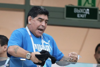 Фотография к новости: Марадону будут экстренно оперировать после кровоизлияния в мозг - СМИ