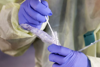 Фотография к новости: Еще 177 человек выздоровели от COVID-19 в Казахстане