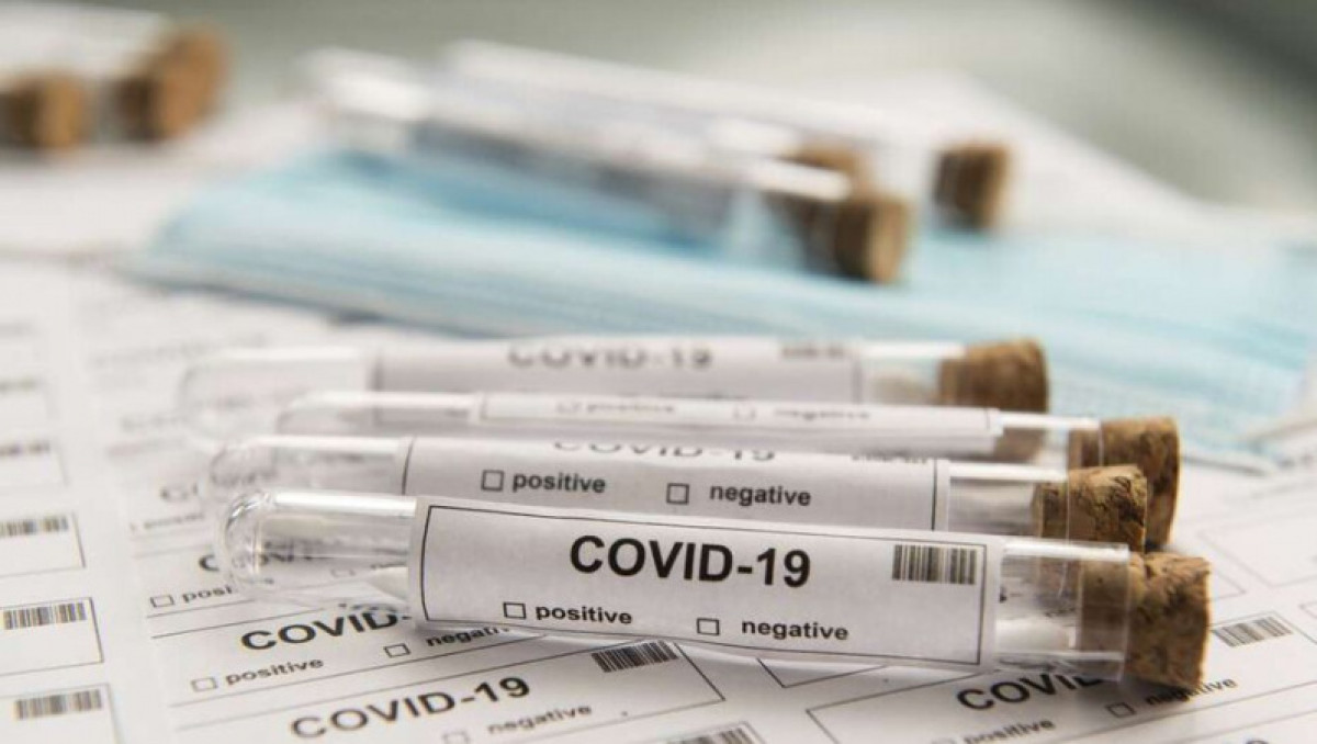 Разоблачен фейк о заражении коронавирусом через ПЦР-тест