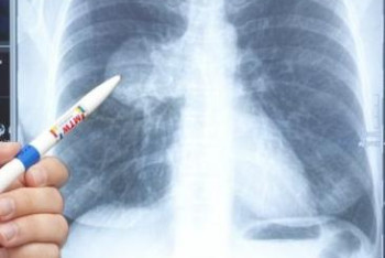 Фотография к новости: Число заболевших коронавирусной пневмонией в РК достигло 40 197