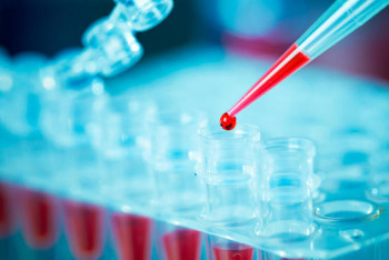 Фотография к новости: "Скрывали статистику КВИ": в Минздраве РК прокомментировали ситуацию