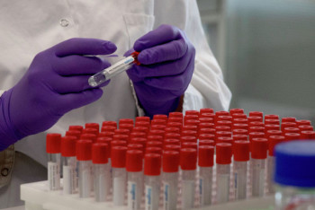 Фотография к новости: 822 новых случая коронавируса выявили за сутки в Казахстане