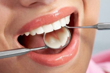 Фотография к новости: Коронавирус может привести к выпадению зубов