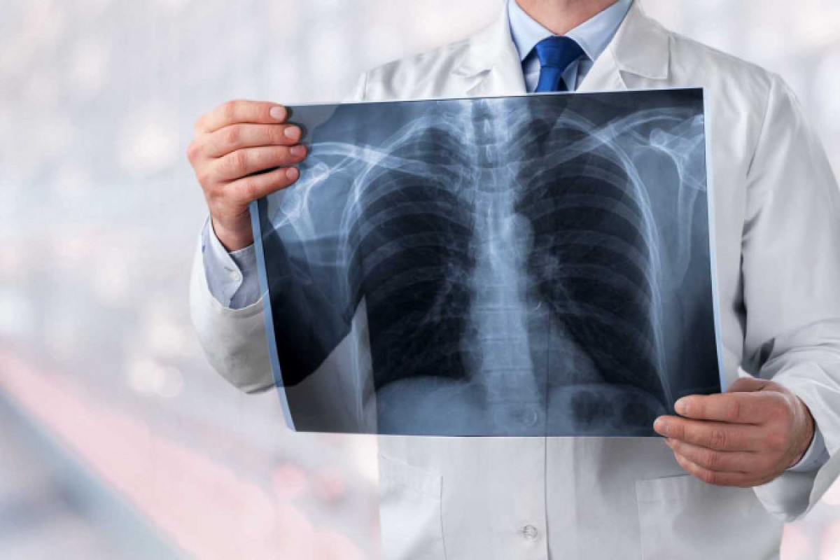 Еще пять человек скончались от коронавирусной пневмонии в РК