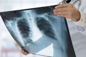 Фотография к новости: Еще 18 человек заболели коронавирусной пневмонией в РК