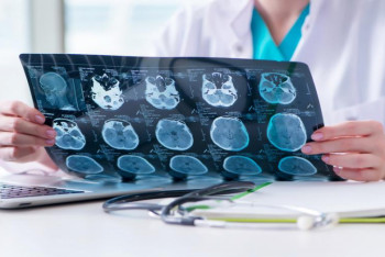 Фотография к новости: Биолог рассказала, как коронавирус может поражать мозг