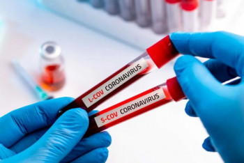 Фотография к новости: 753 новых случая коронавируса выявили за сутки в Казахстане