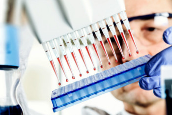 Фотография к новости: Обнаружены биомаркеры, помогающие определить точное время смерти в воде