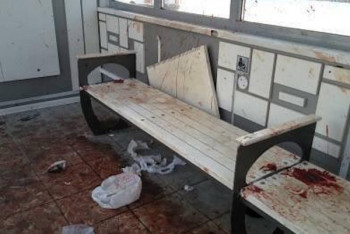 Фотография к новости: Окровавленная остановка шокировала жителей Усть-Каменогорска