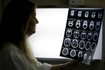 Фотография к новости: Ученые выяснили, как коронавирус влияет на сосуды мозга