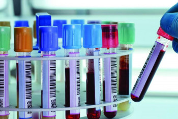 Фотография к новости: Число заболевших коронавирусом превысило 157 000 в Казахстане