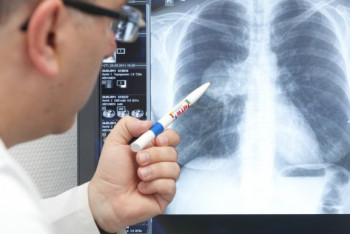 Фотография к новости: Пневмония с признаками коронавируса: семь заболевших и четверо умерших за сутки