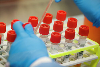 Фотография к новости: 742 заболевших коронавирусом выявили за сутки в Казахстане