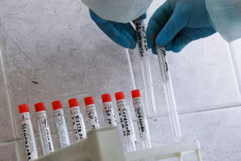 Фотография к новости: Более 840 новых случаев коронавируса выявили за сутки в Казахстане