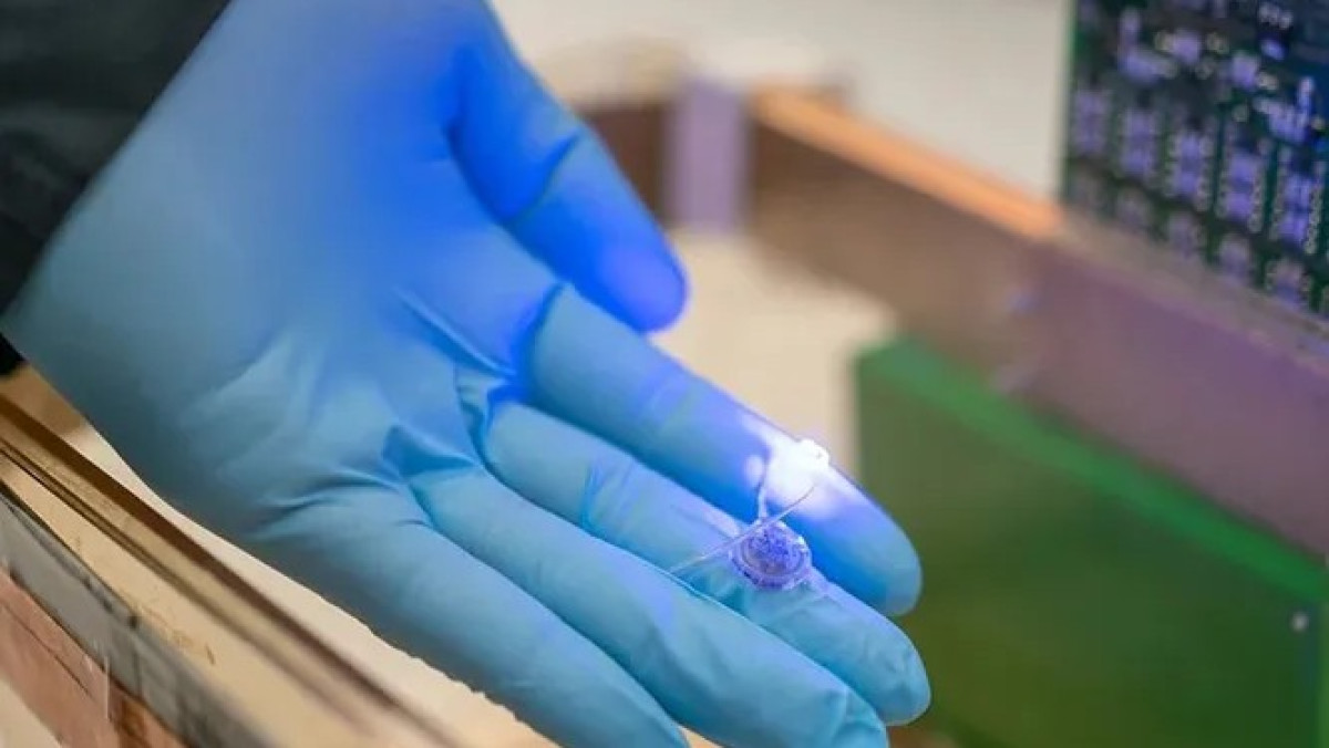 Миниатюрный имплант для похудения изобрели в США