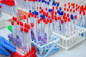 Фотография к новости: Коронавирус: "красная зона" обновилась в Казахстане