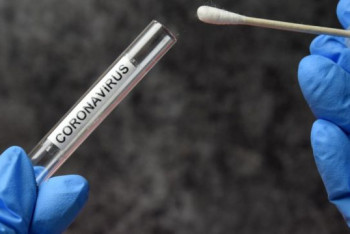 Фотография к новости: Число новых случаев коронавируса за сутки назвали в Минздраве РК