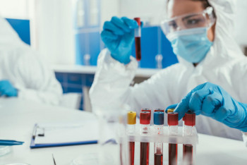 Фотография к новости: Пик эпидемии коронавируса в Казахстане возможен в марте - Цой