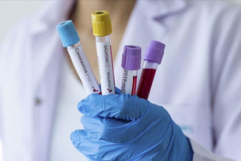 Фотография к новости: 1134 инфицированных коронавирусом выявили за сутки в Казахстане