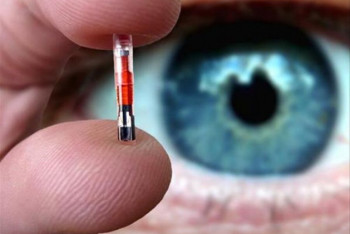 Фотография к новости: Казахстанцев не будут чипировать - Минздрав РК