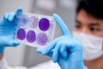 Фотография к новости: Названы сроки появления коллективного иммунитета к COVID-19