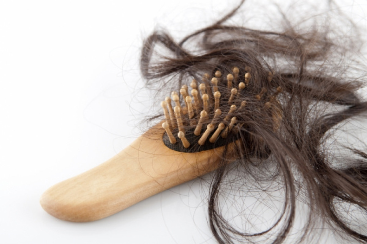 alopecyja.ru
