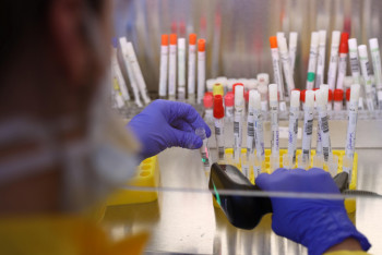 Фотография к новости: 766 новых случаев коронавируса выявили за сутки в Казахстане