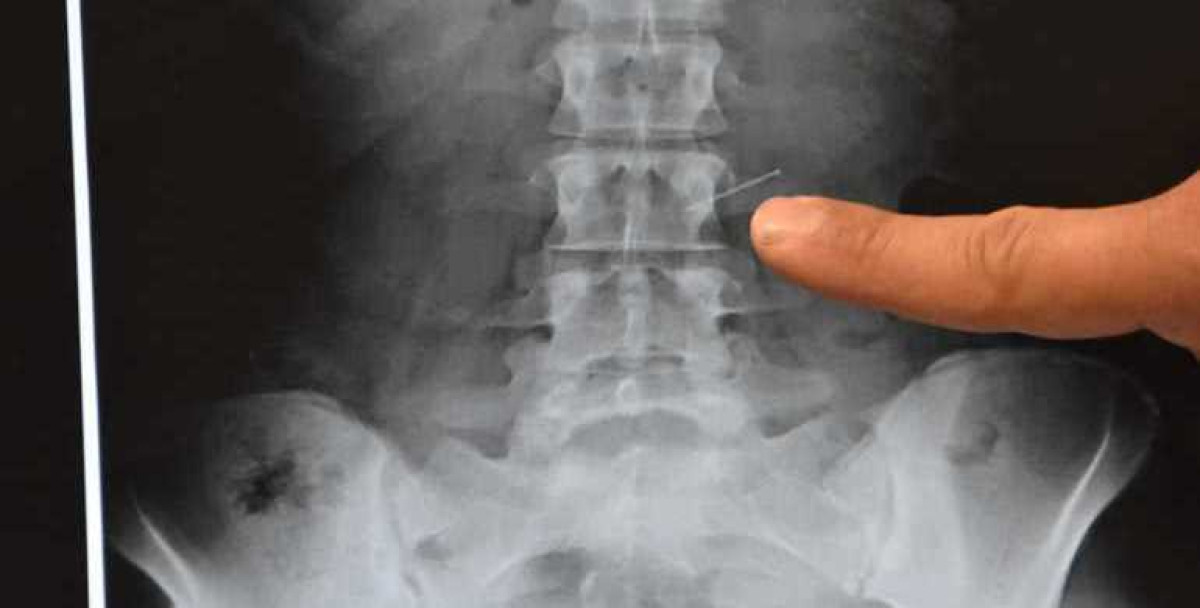 иллюстративное