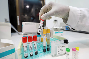 Фотография к новости: Определена самая подверженная раку группа крови