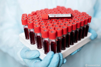 Фотография к новости: 802 новых случая коронавируса выявили за сутки в Казахстане