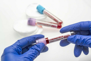 Фотография к новости: Более тысячи новых случаев коронавируса выявили за сутки в Казахстане