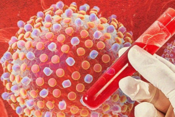 Фотография к новости: Обновлена казахстанская матрица оценки эпидемиологической ситуации