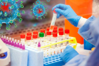 Фотография к новости: 1310 новых случаев КВИ выявили за сутки в Казахстане