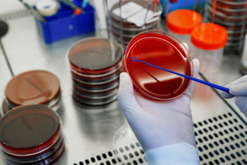 Фотография к новости: ВОЗ озвучила новую версию происхождения коронавируса