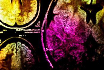 Фотография к новости: Судороги и галлюцинации: канадцев косит неизвестная болезнь