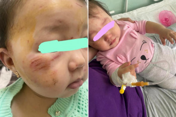 Фотография к новости: Полуторагодовалую девочку избили в образовательном центре Алматы